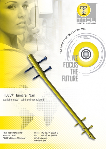 FIDES Humeral Nail System