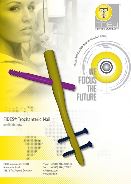 FIDES Trochanteric Nail System