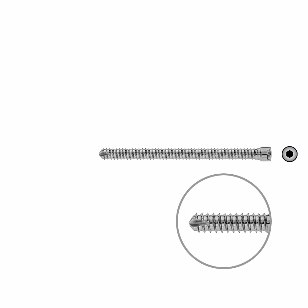 V-Bolzen Femur 84mmx dia 6,4mm 