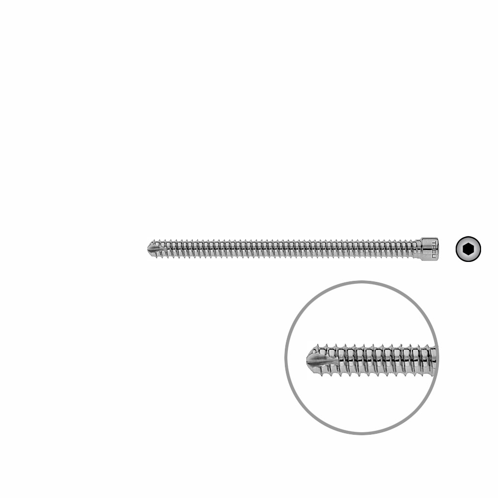 V-Bolzen Femur 88mmx dia 6,4mm 