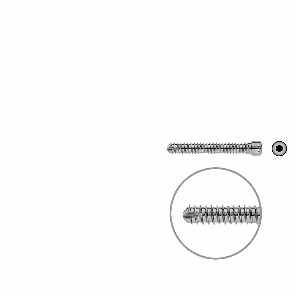 V-Bolzen Femur 48mmx dia 6,4mm 