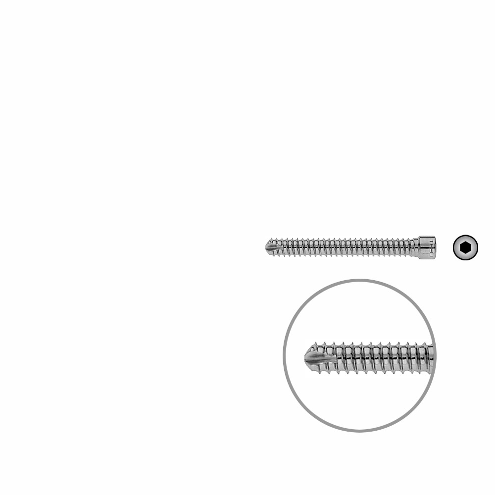 V-Bolzen Femur 52mmx dia 6,4mm 