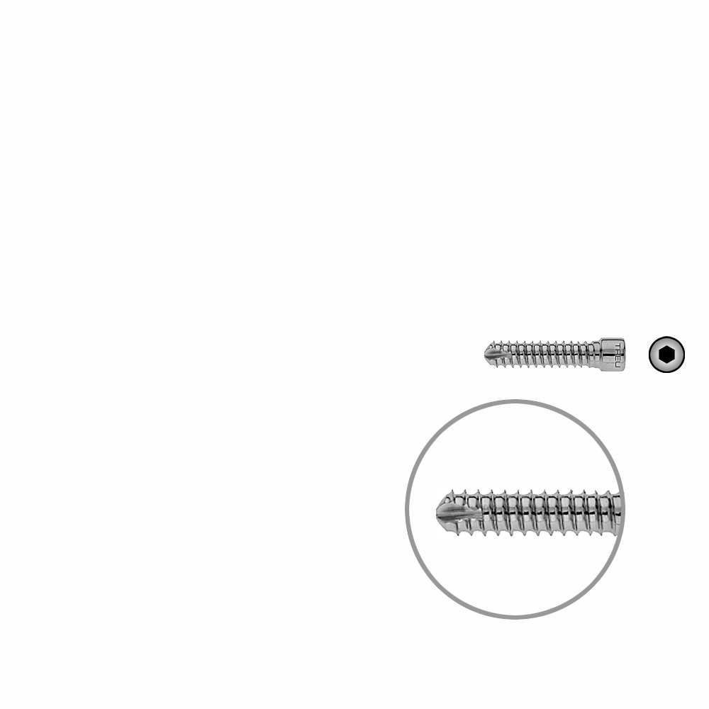 V-Bolzen Femurnagel 30mmx dia 6,4mm 