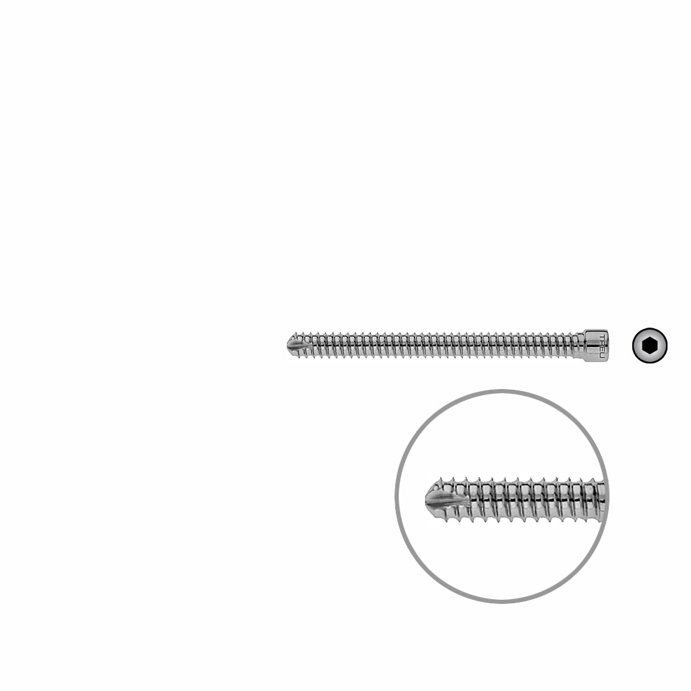 V-Bolzen Femur 70mmx dia 6,4mm 