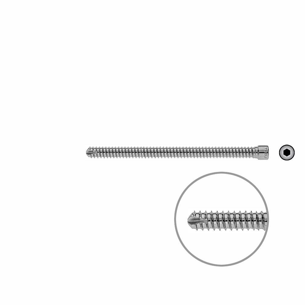 V-Bolzen Femur 90mmx dia 6,4mm 