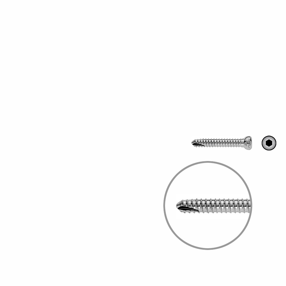 V-Schraube Femur 32mm x dia 5mm 