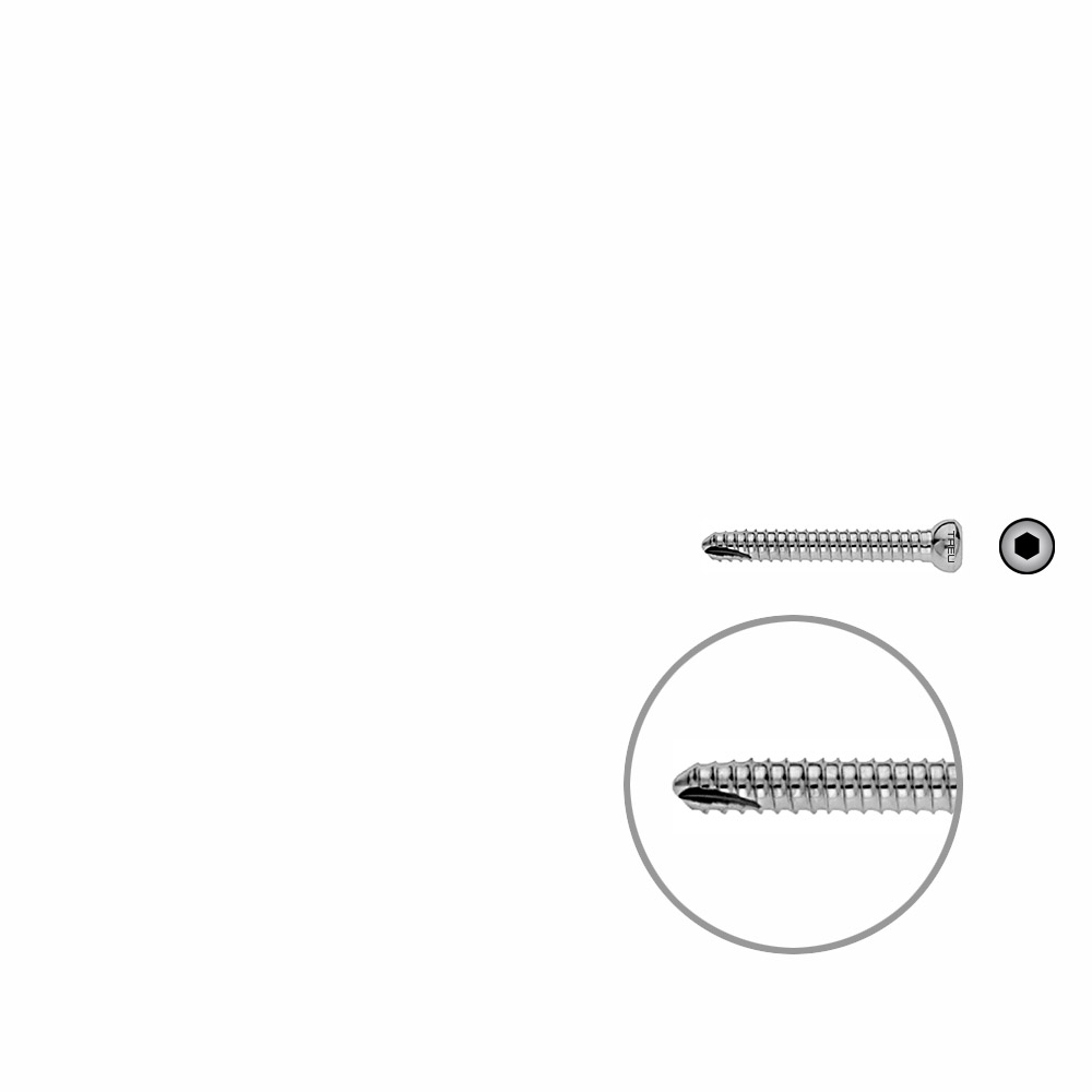 V-Schraube Femur 36mm x dia 5mm 