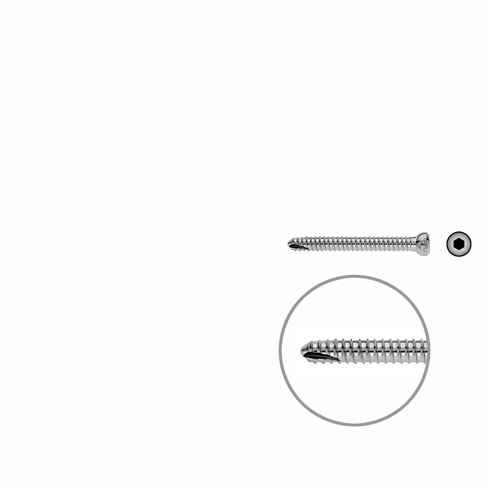 V-Schraube Femur 44mm x dia 5mm 