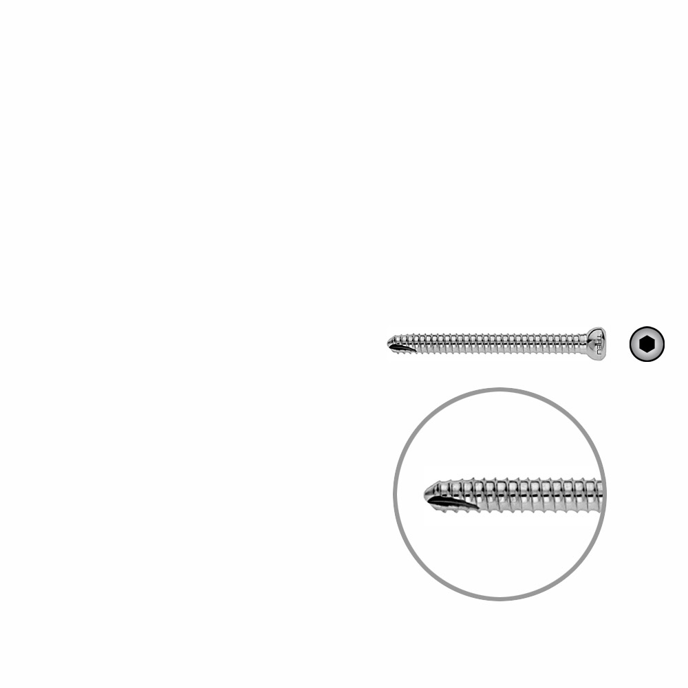 V-Schraube Femur 48mm x dia 5mm 