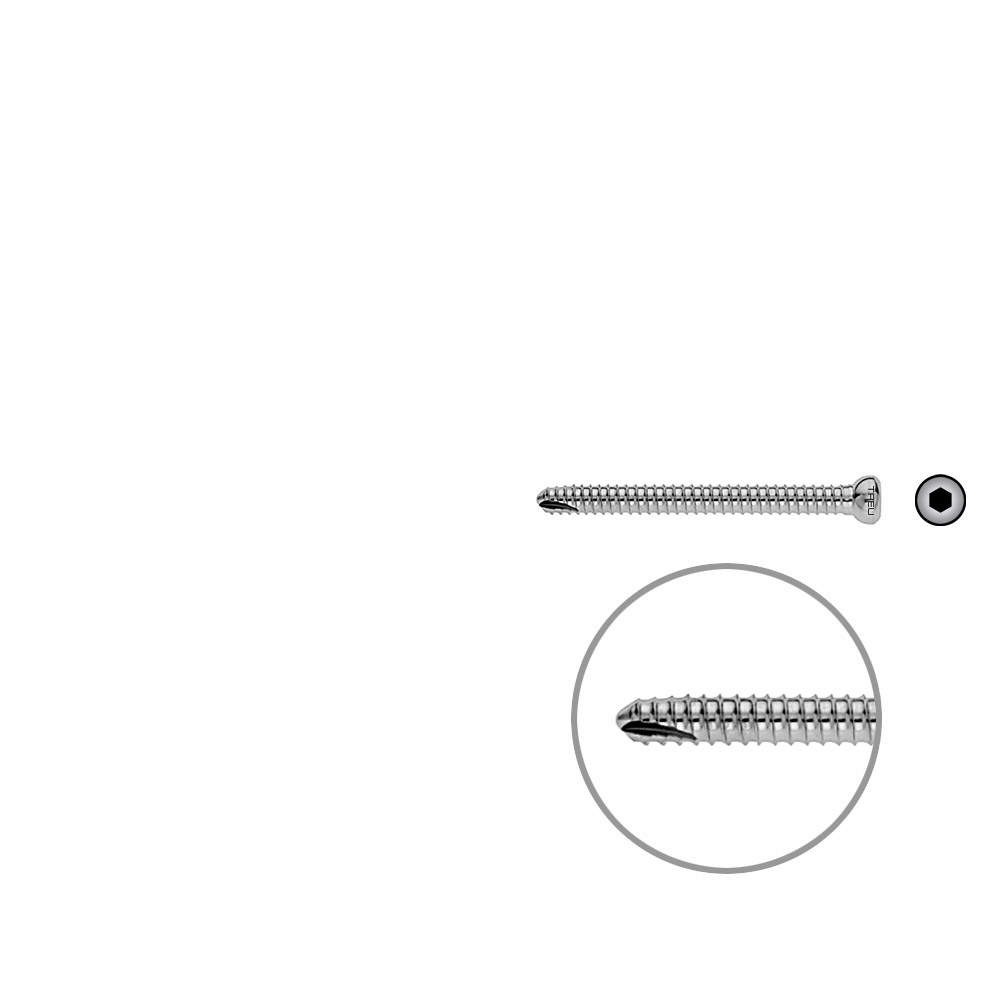 V-Schraube Femur 52mm x dia 5mm 