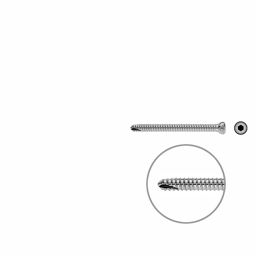 V-Schraube Femur 56mm x dia 5mm 