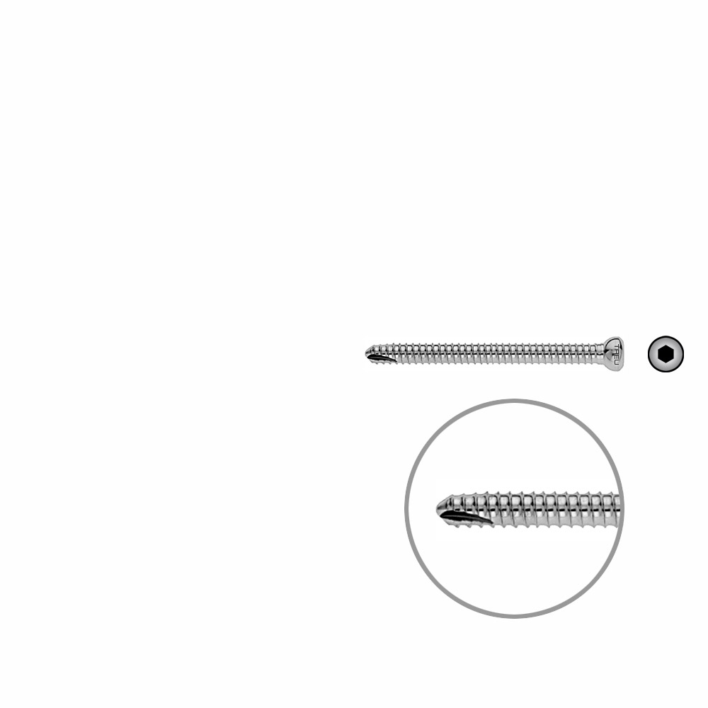 V-Schraube Femur 55mm x dia 5mm 