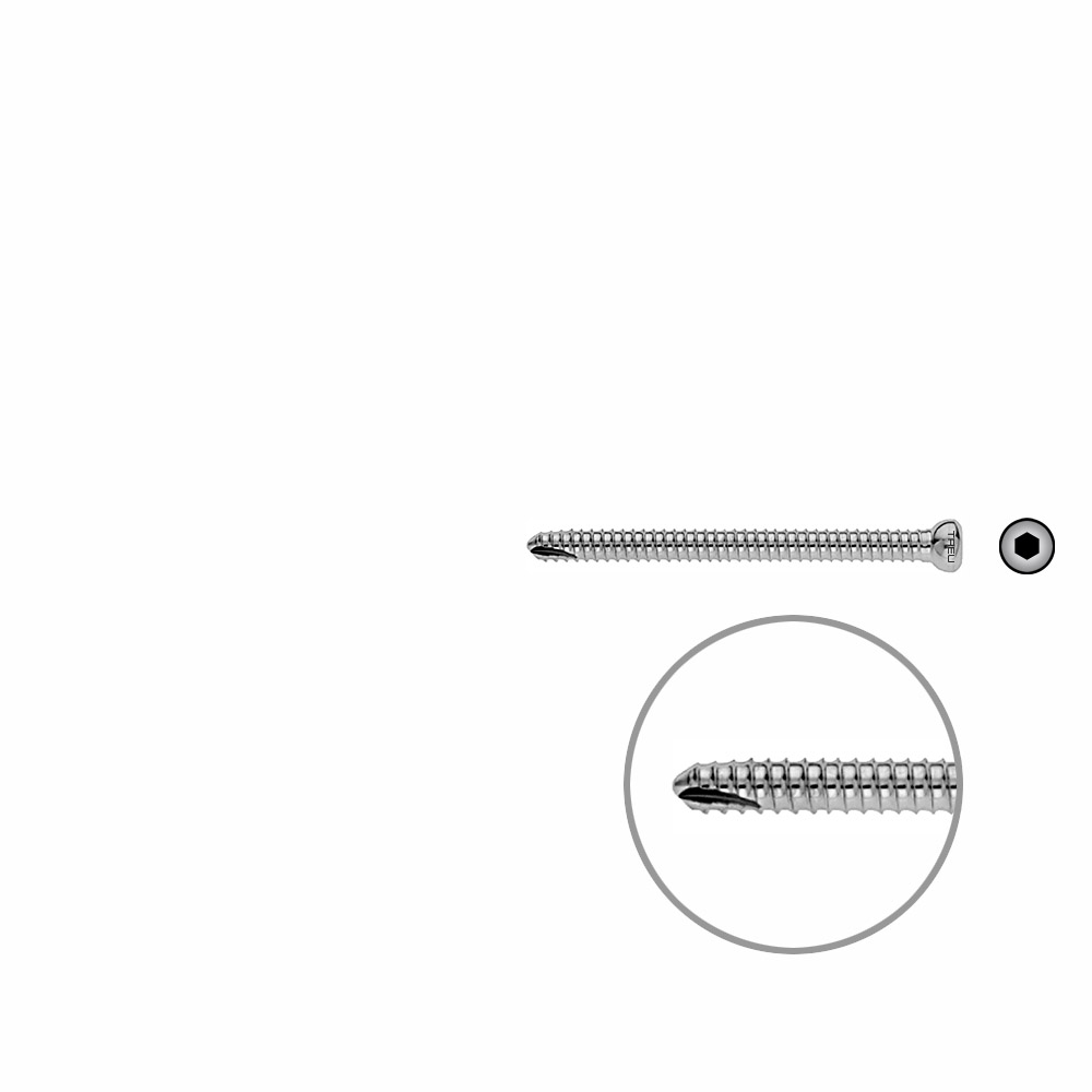 Femoral Locking Screw 60mm x dia 5mm 