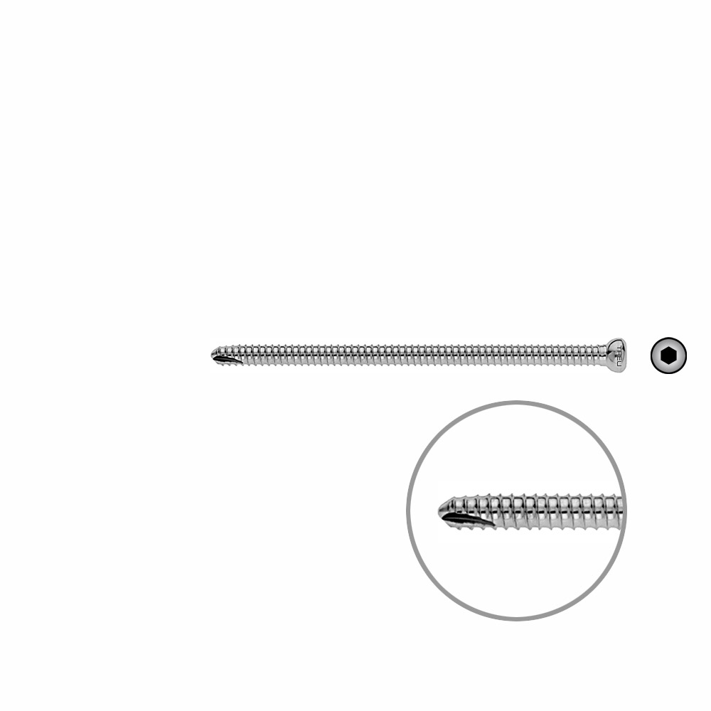 V-Schraube Femur 88mm x dia 5mm 