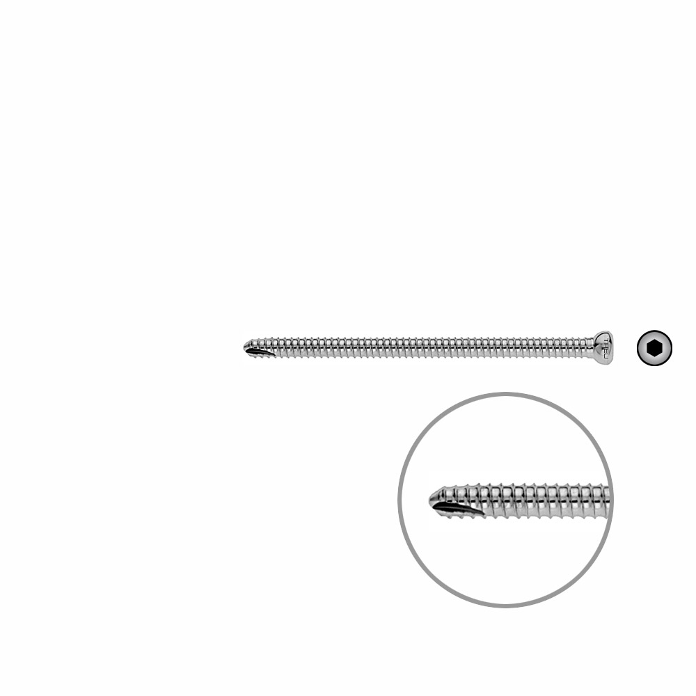 V-Schraube Femur 80mm x dia 5mm 