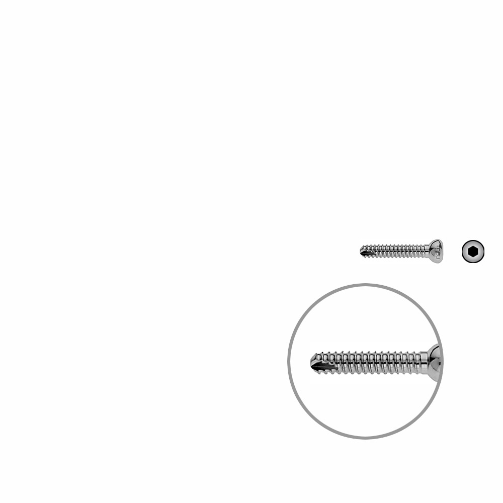 Locking Screw UR 25mm x dia 4,5mm 