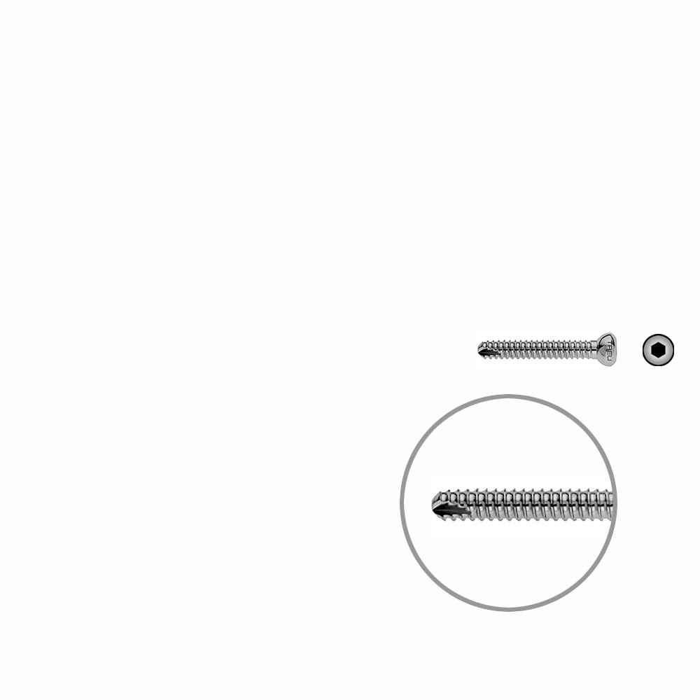 Locking Screw UR 30mm x dia 4,5mm 