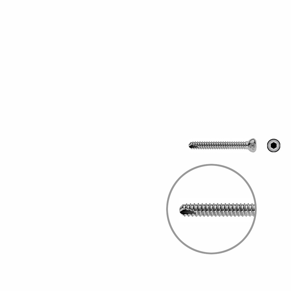 Locking Screw UR 35mm x dia 4,5mm 