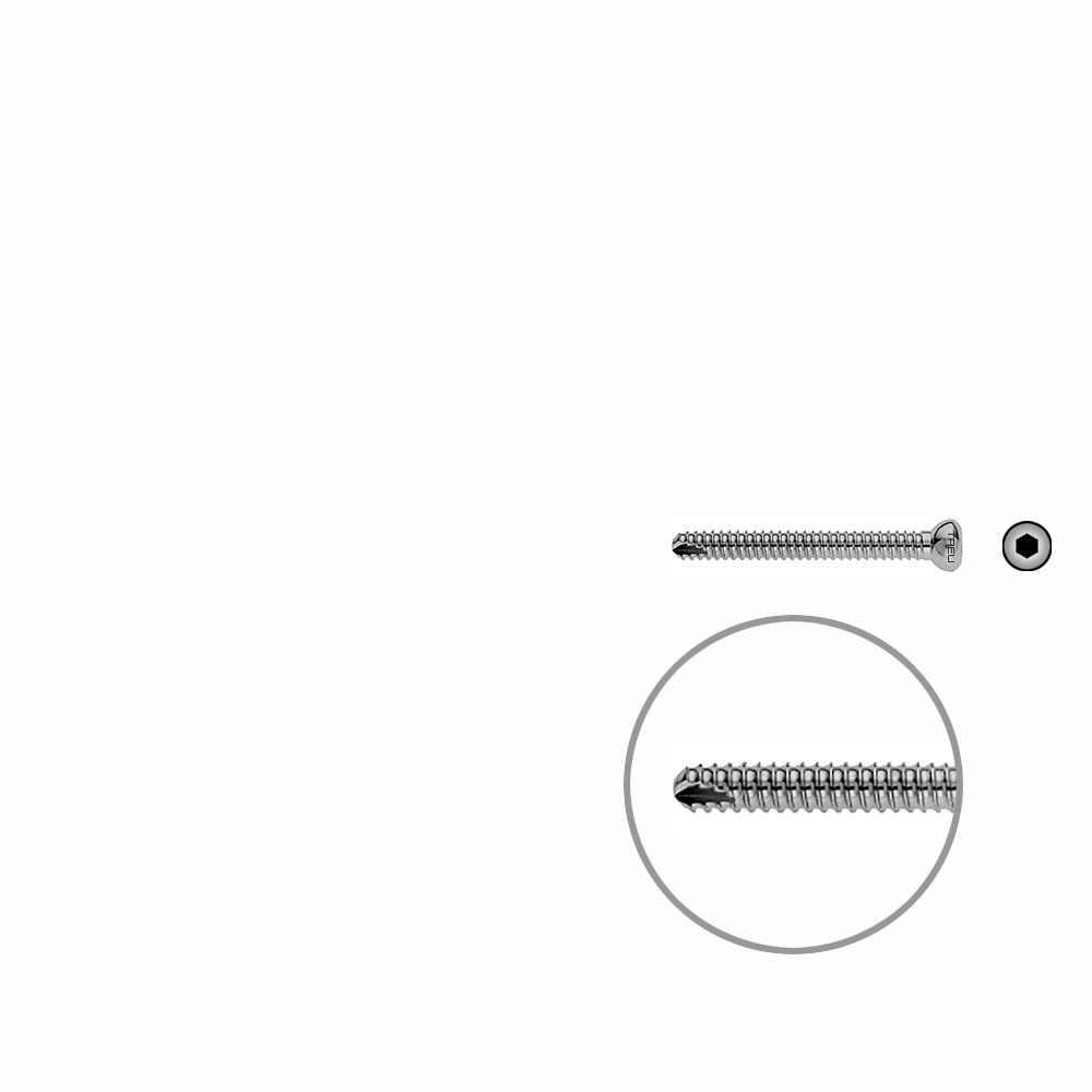 Locking Screw UR 40mm x dia 4,5mm 