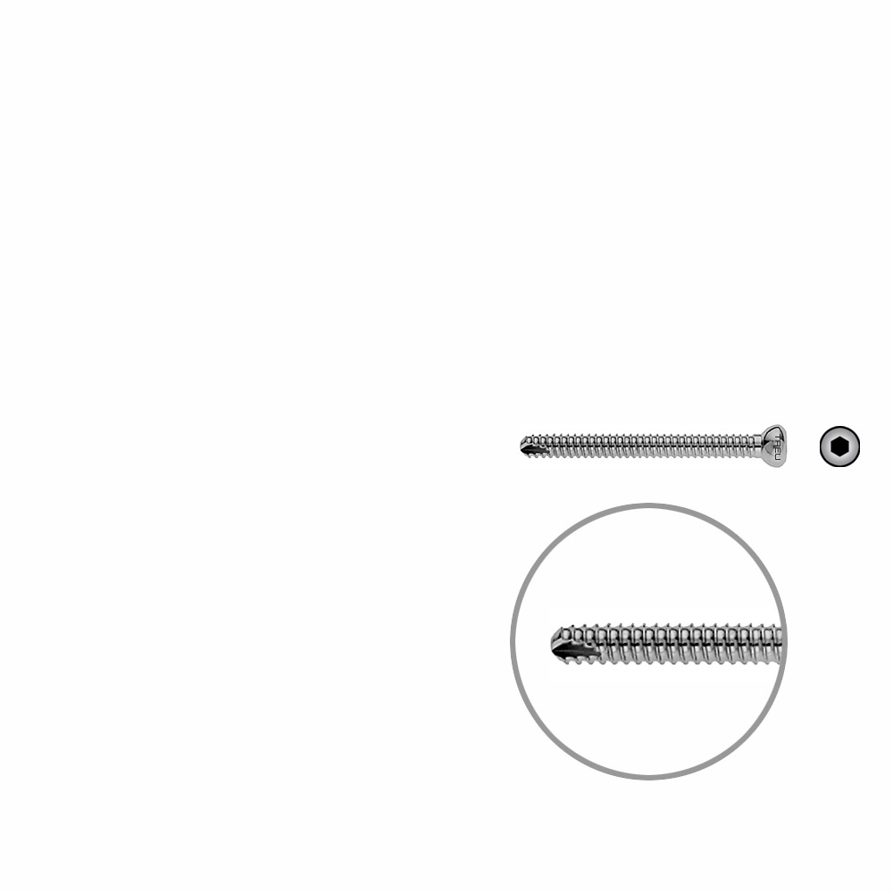 Locking Screw UR 45mm x dia 4,5mm 