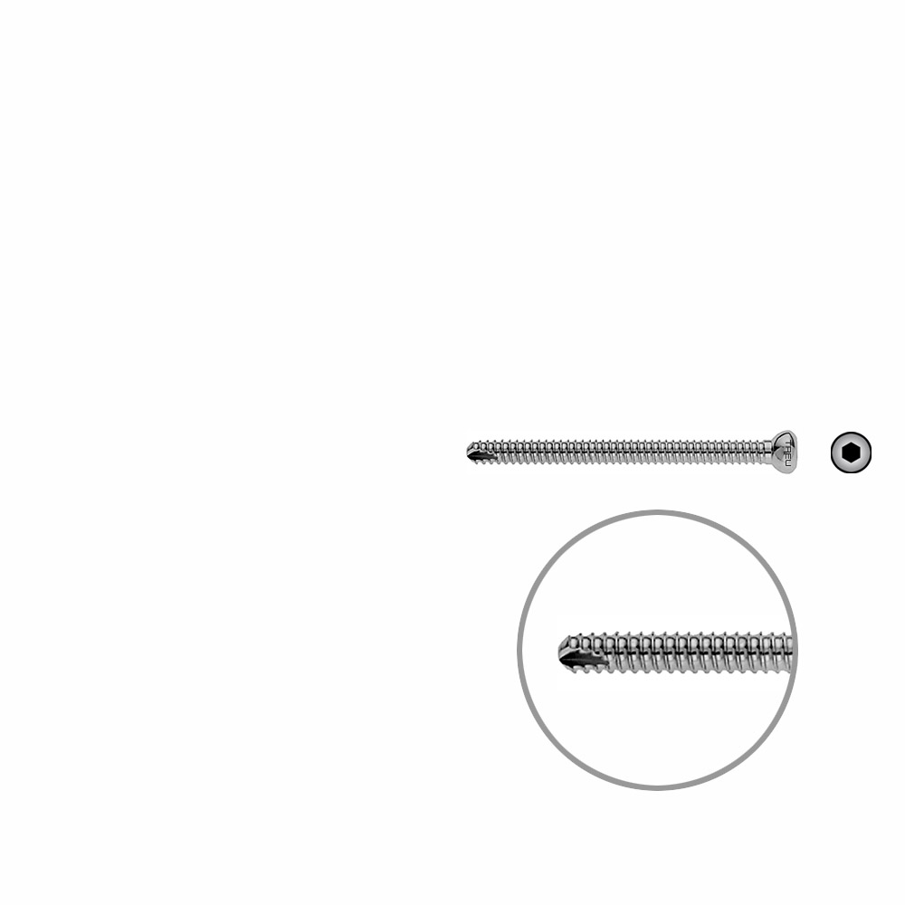 Locking Screw UR 55mm x dia 4,5mm 