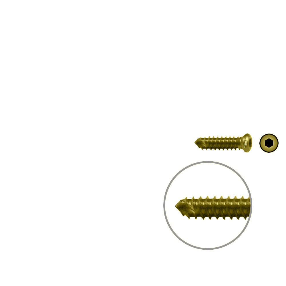 FIDES V-Schraube Humerus 14mm x 3,5mm TITAN 