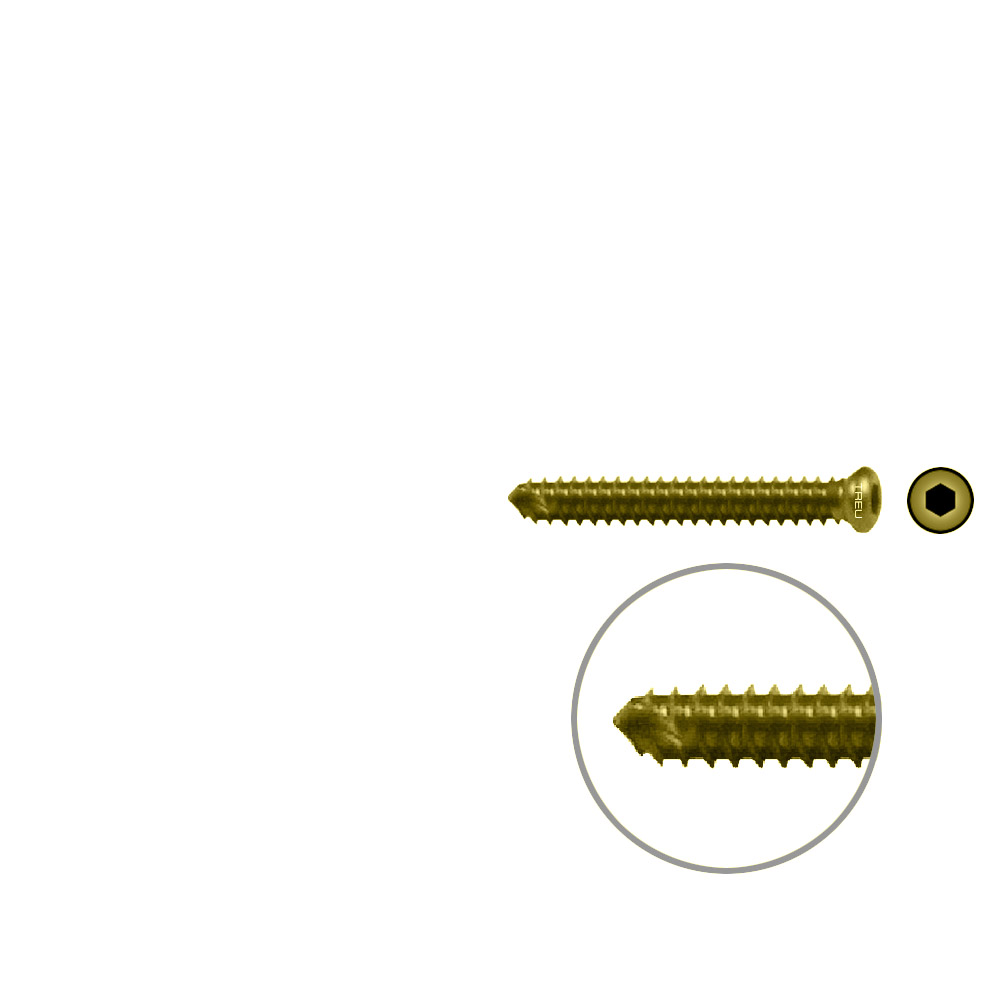 FIDES V-Schraube Humerus 26mm x 3,5mm TITAN 