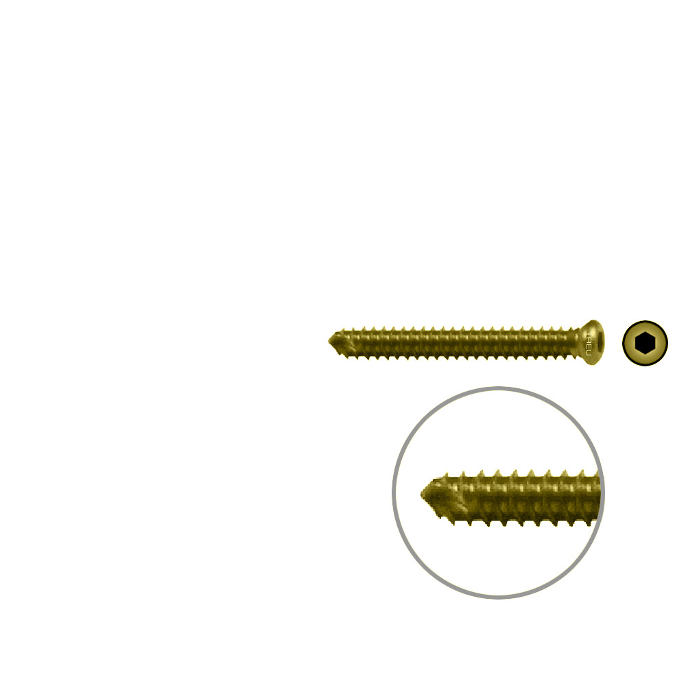 FIDES Humer.Lock. Screw 28mm x dia 3,5mm TI 