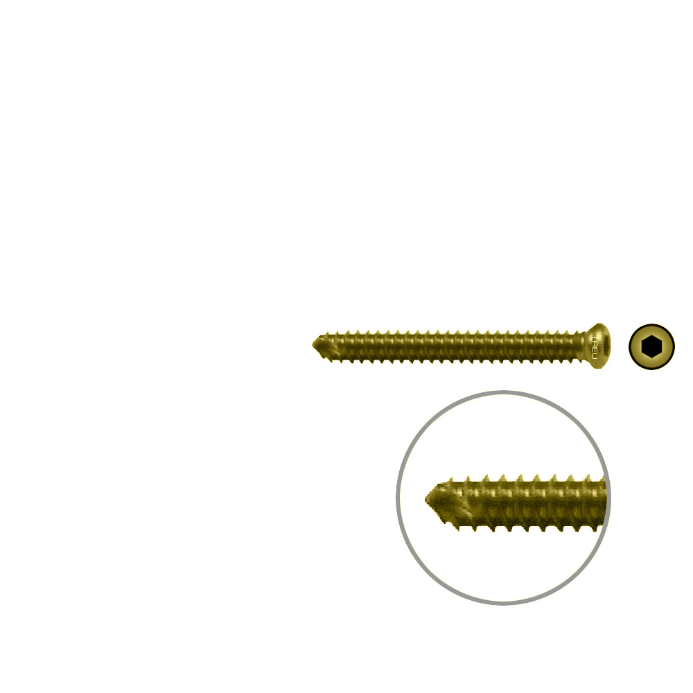 FIDES V-Schraube Humerus 30mm x 3,5mm TITAN 