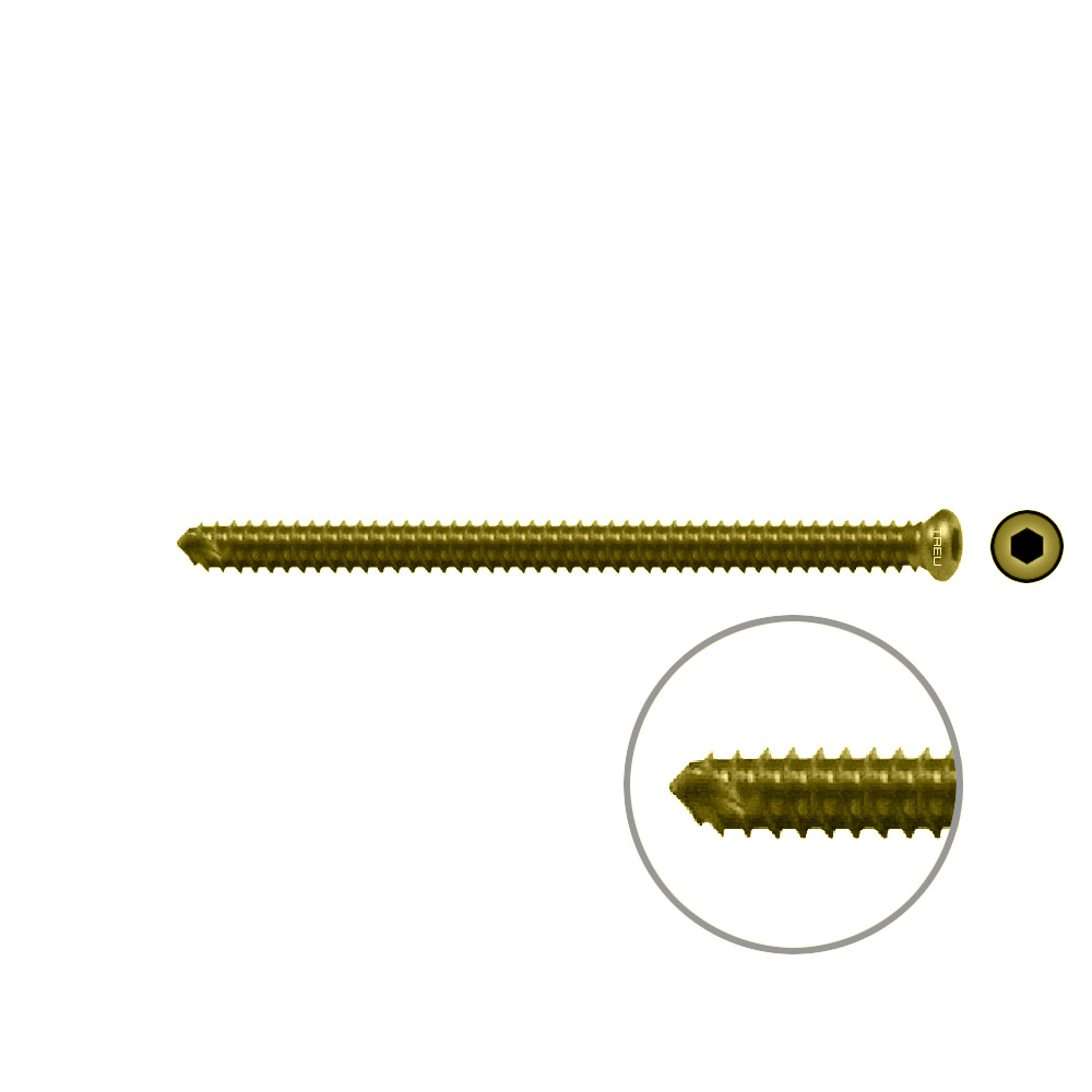 FIDES V-Schraube Humerus 50mm x dia 3,5m TITAN 