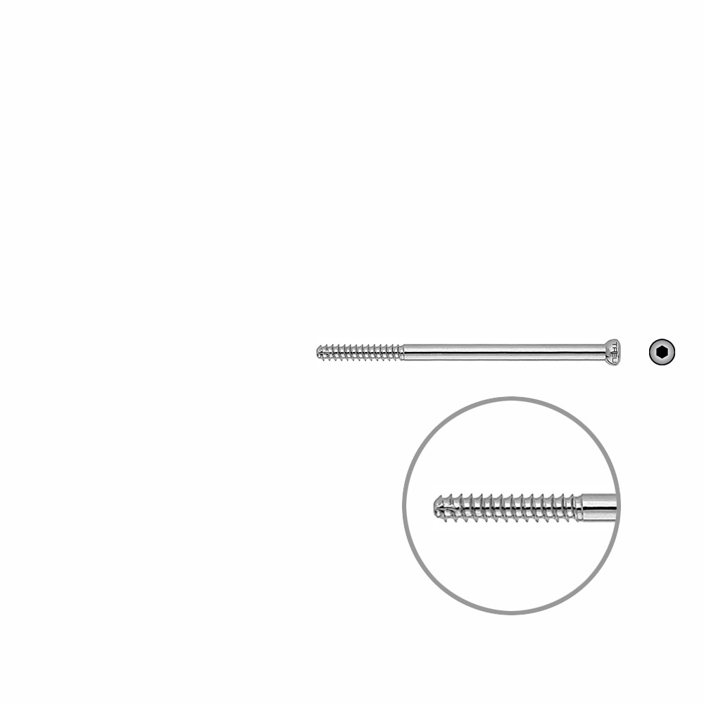 D.N.S. Lag Screw 65mm x dia 5mm 