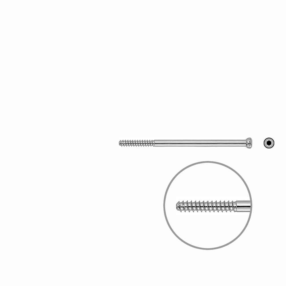 D.N.S. Lag Screw 70mm x dia 5mm 