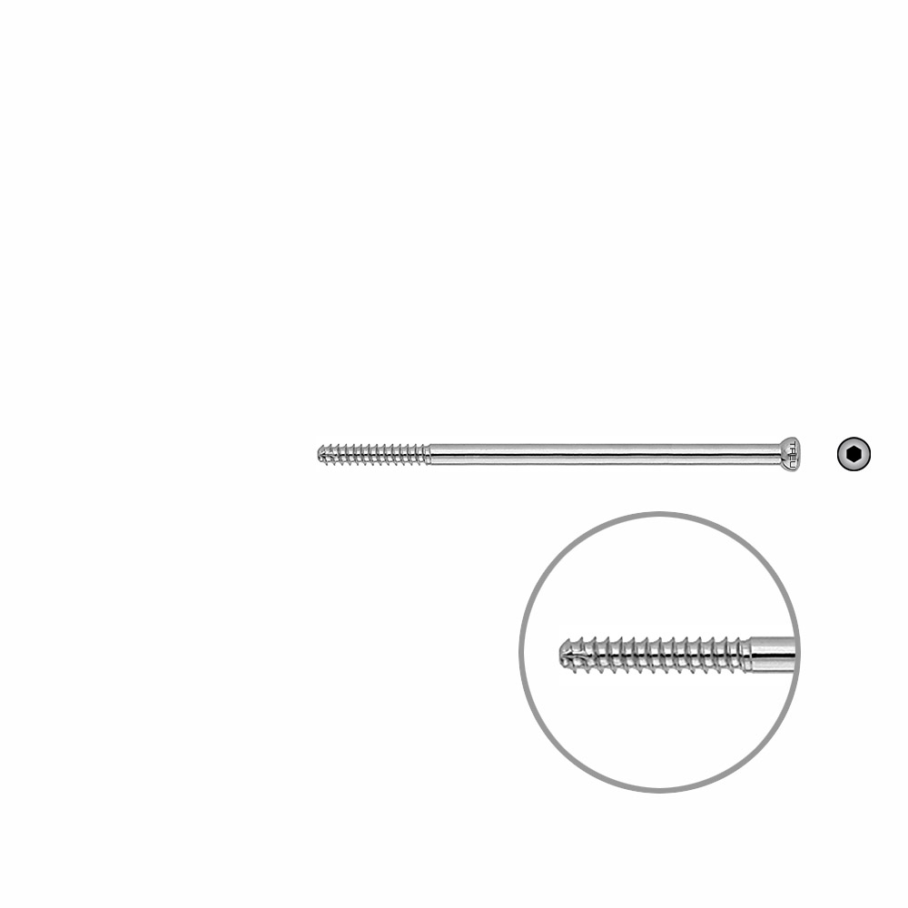 D.N.S. Zugschraube 80mm x dia 5mm 