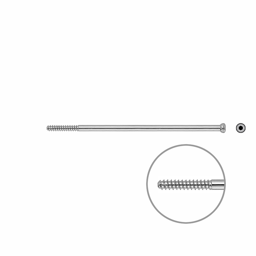 D.N.S. Lag Screw 105mm x dia 5mm 