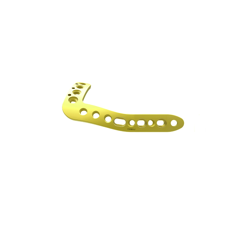 TS 3.5 LOCKIT antero-Lateral distal tibia plate, left 5 H, 80mm Titanium 