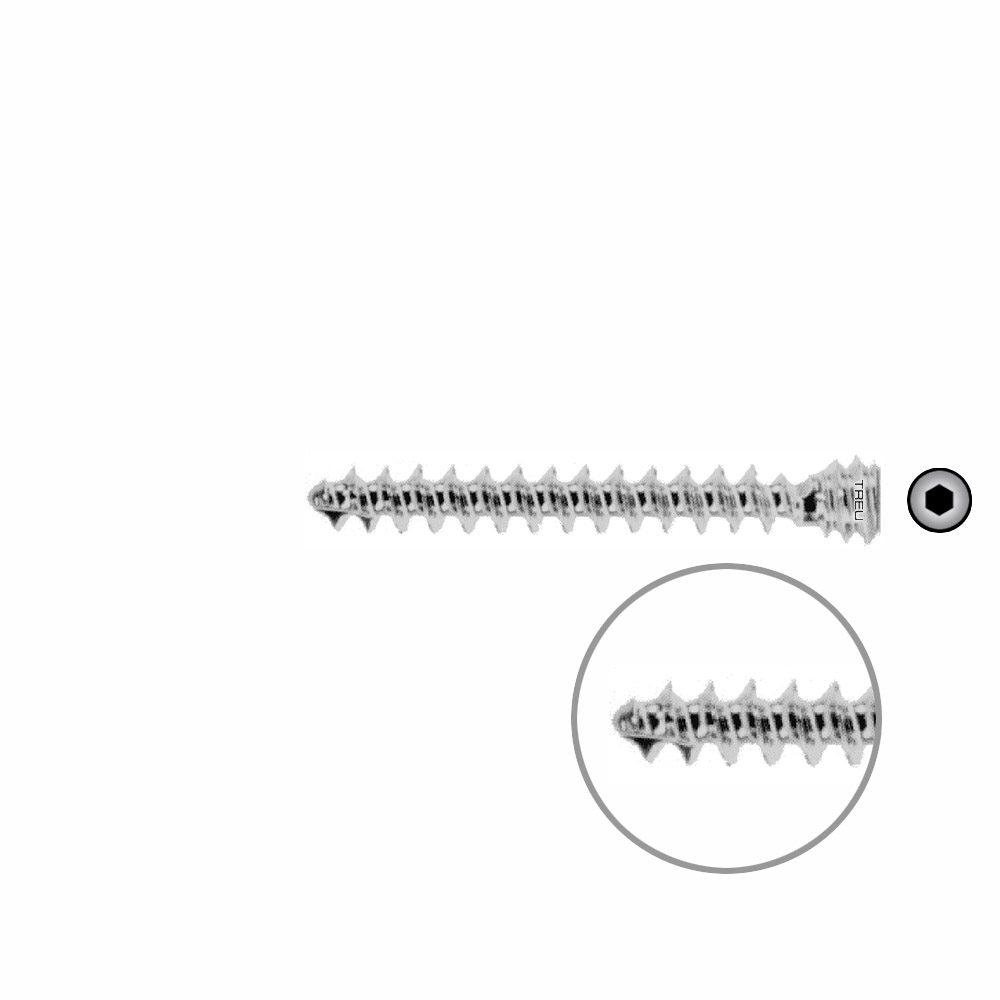 Humeral locking screw Ø 6,0 mm x 40 mm 