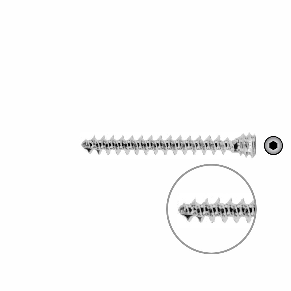 Humeral locking screw Ø 6 mm x 42 mm 