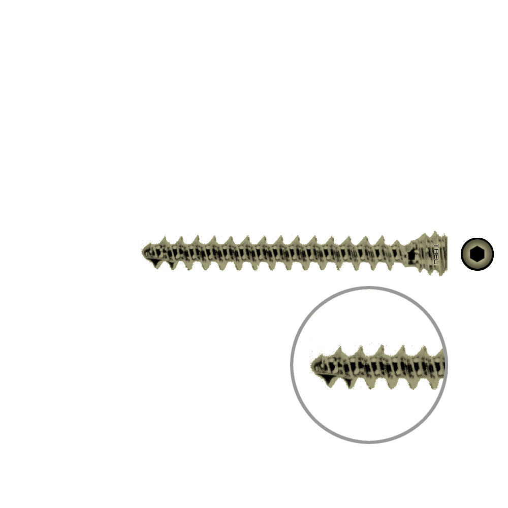 Schraube für Humeruskopfverschraubung Ø 6,0 mm, Länge 42 mm, TITAN 