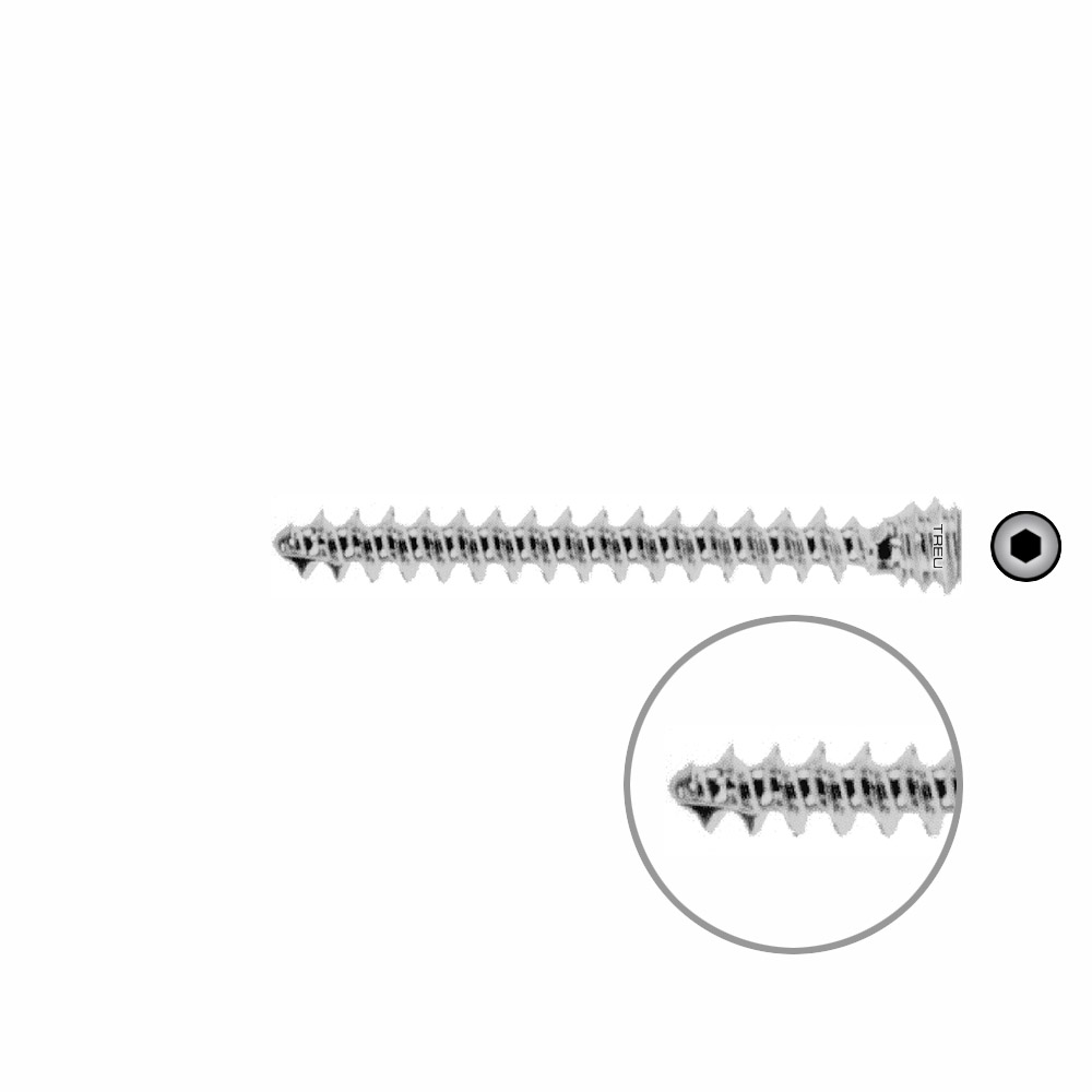 Schraube für Humeruskopfverschraubung Ø 6,0 mm, Länge 44 mm 