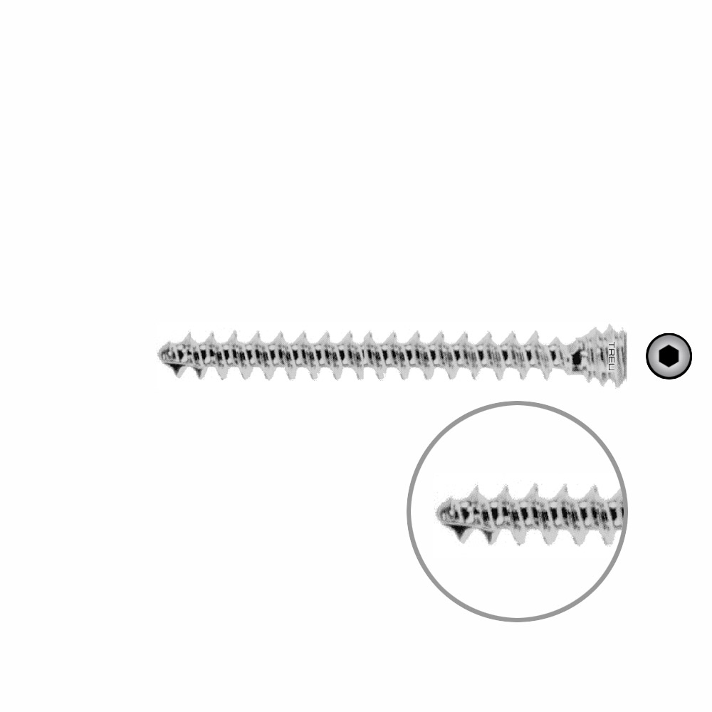 Humeral locking screw Ø 6,0 mm x 46 mm 