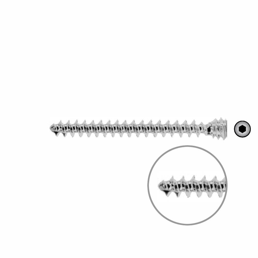 Humeral locking screw Ø 6,0 mm x 48 mm 