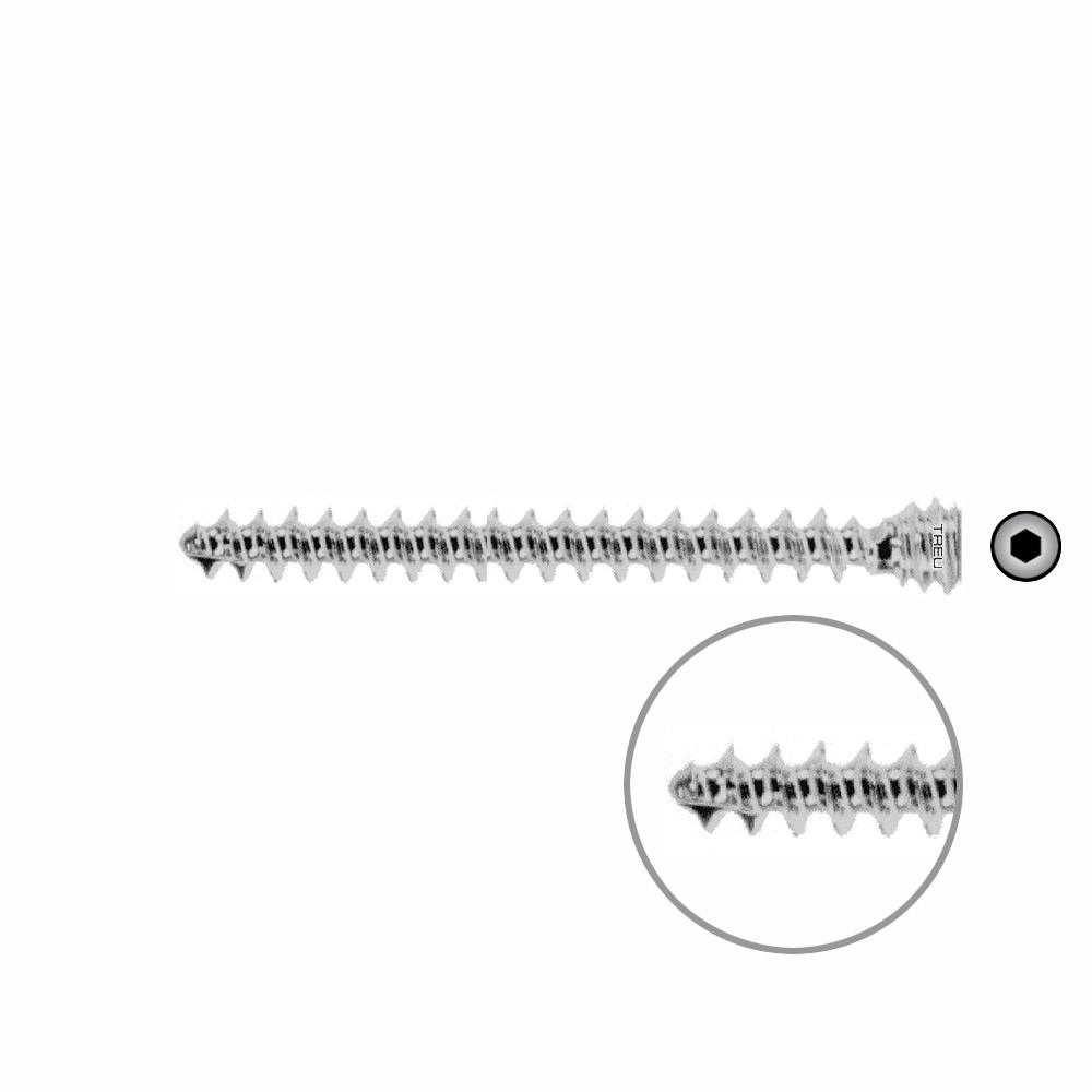 Schraube für Humeruskopfverschraubung Ø 6,0 mm, Länge 50 mm 