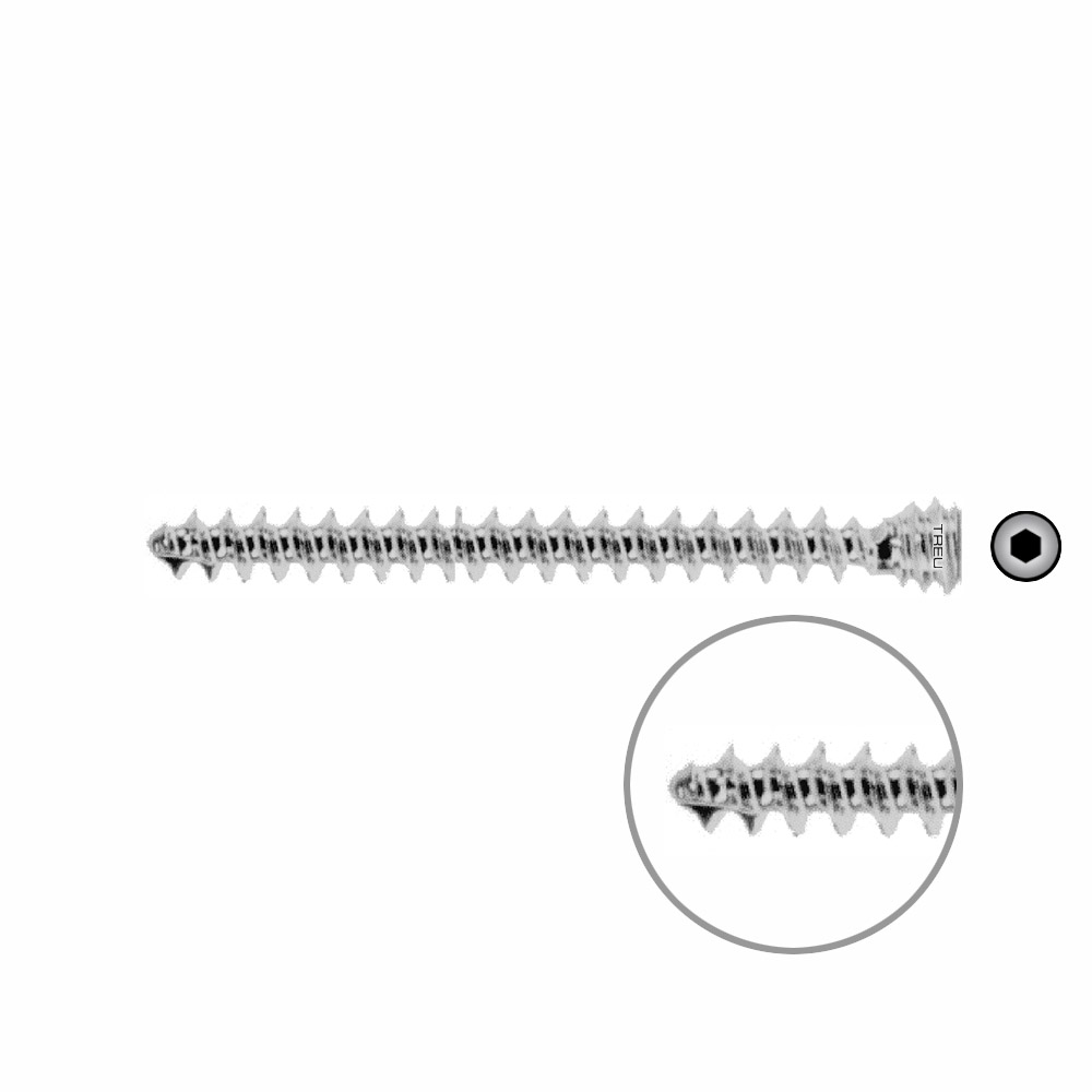 Schraube für Humeruskopfverschraubung Ø 6,0 mm, Länge 52 mm 