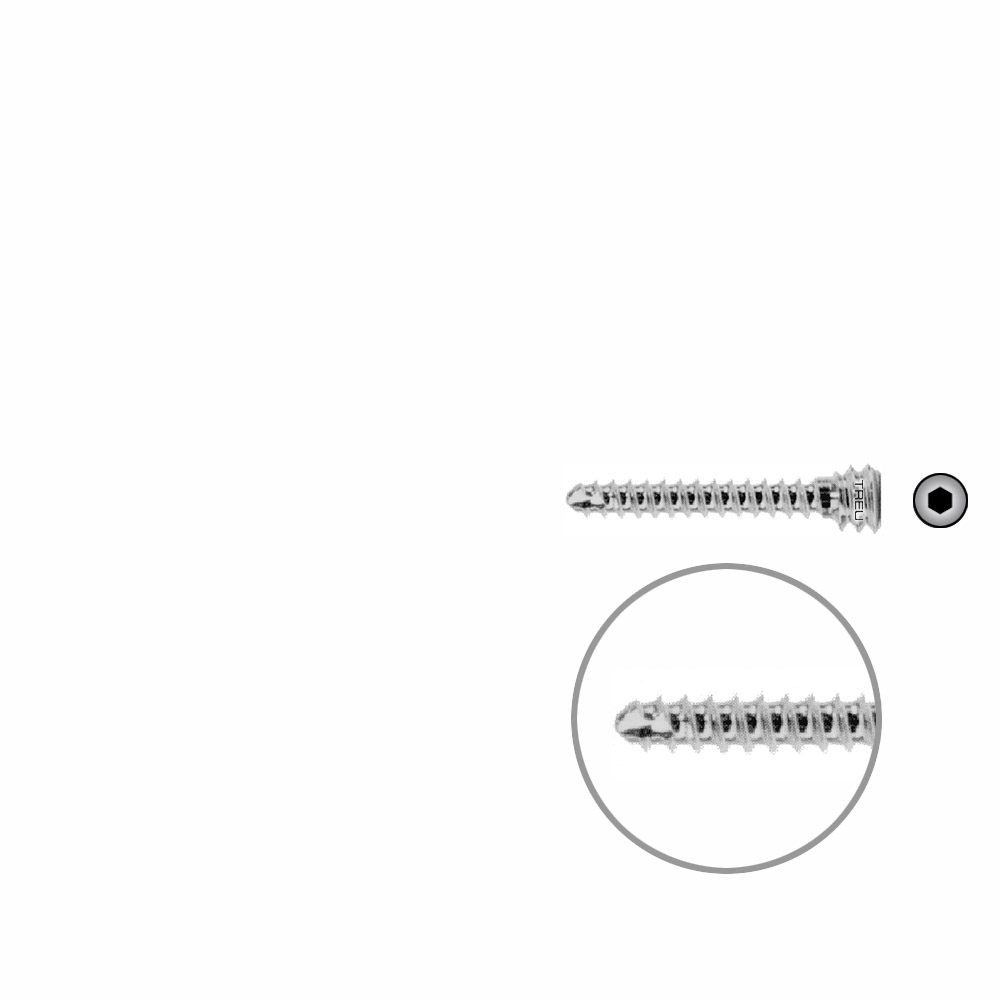 Schraube für Schaftverschraubung Ø 4,5, Länge 22 mm 