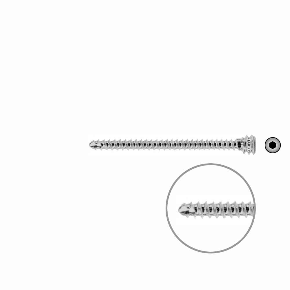 Schraube für Schaftverschraubung Ø 4,5 mm, Länge 40 mm 