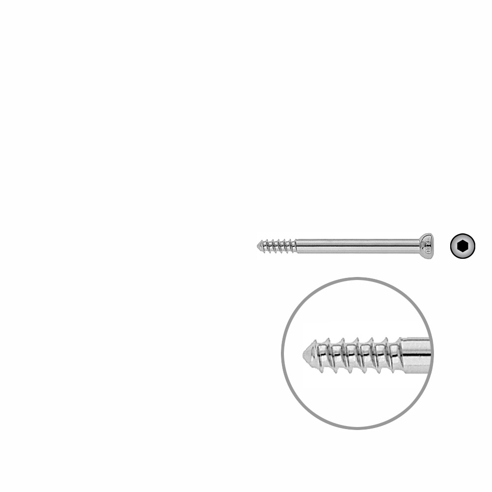 Shank Screw 4.5x54mm 