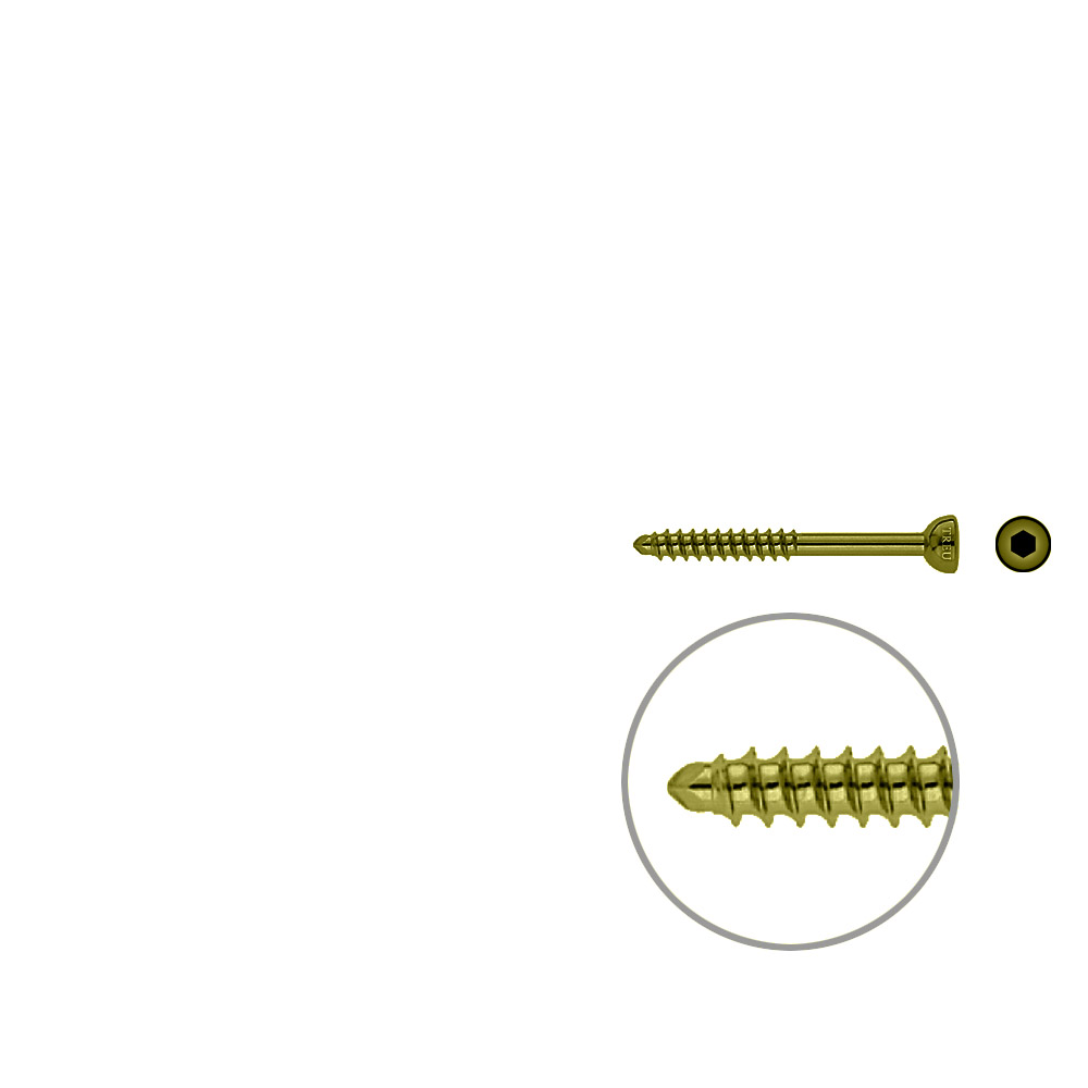 Malleolar screw 4,5x 45mm TITAN 