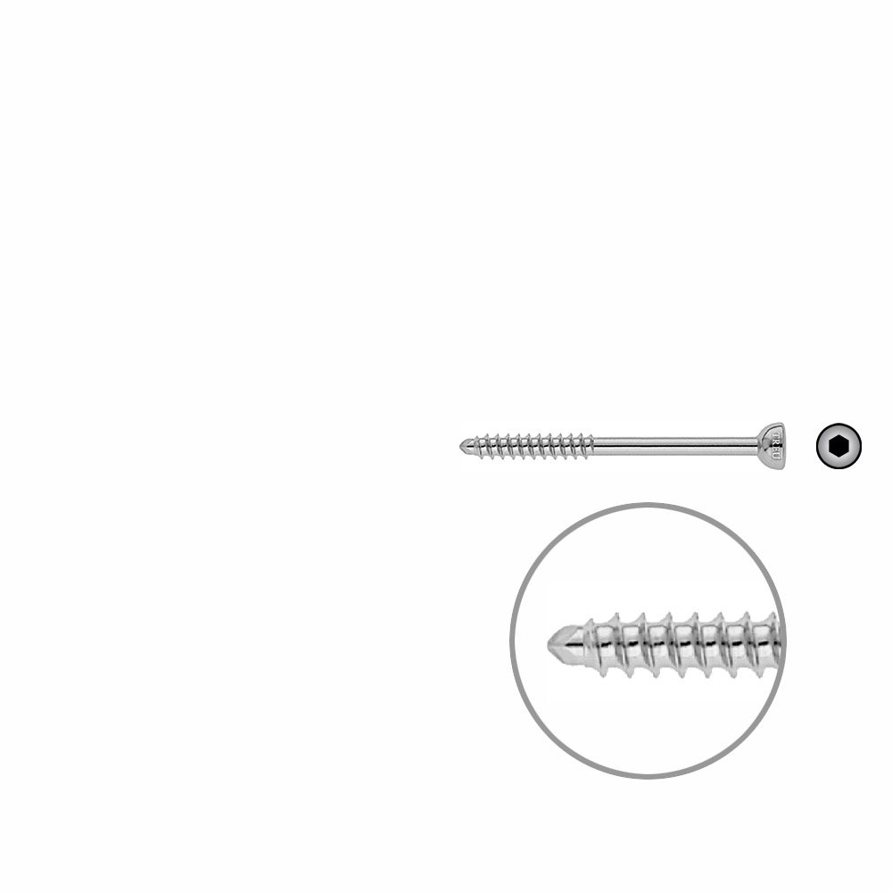 Malleolar screw 4.5x 55mm 