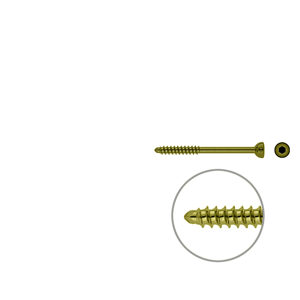 Malleolar screw 4,5x 55mm TITAN 