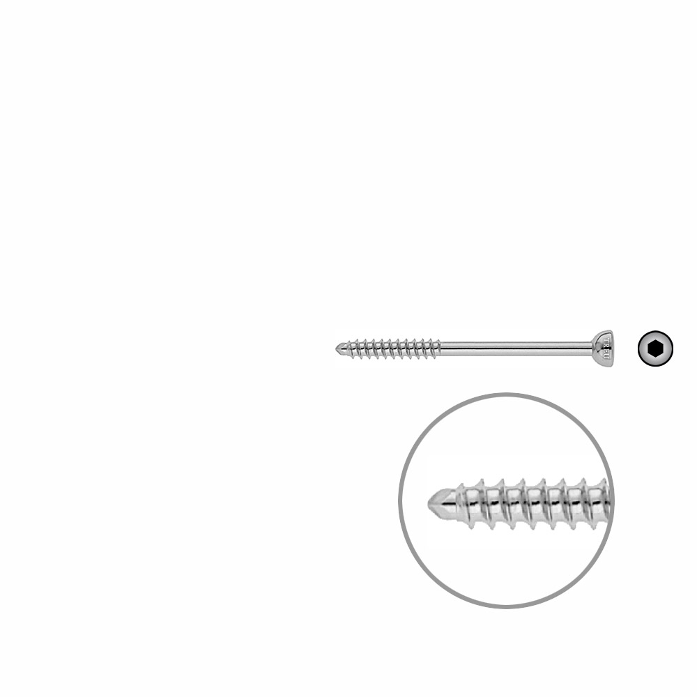 Malleolarschraube 4,5 x 60mm 